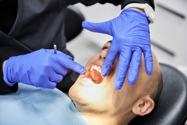 Best Tooth Infection Emergency Dentist  in Baden, MD